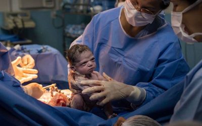 Ensuring Value for Money: Cesarean Delivery Charges in Panchkula Hospitals