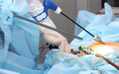 Trusted Laparoscopic Ovarian Surgeon in Panchkula for Fertility & Gynecological Care