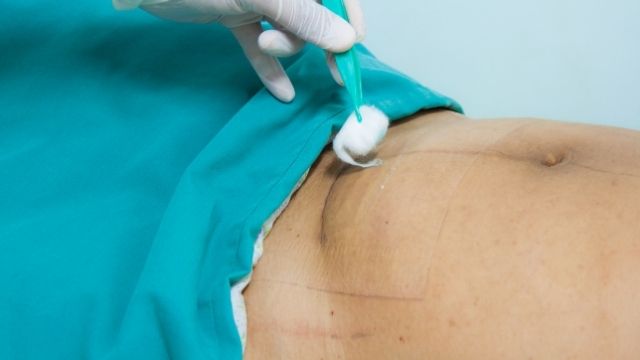 Cesarean Delivery Charges in Panchkula